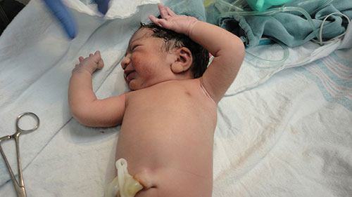 Le Soin Du Cordon De Bebe Le Soin Du Cordon De Bebe