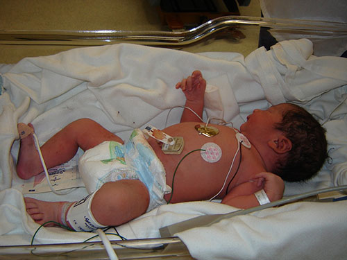 premiers examens bébé naissance